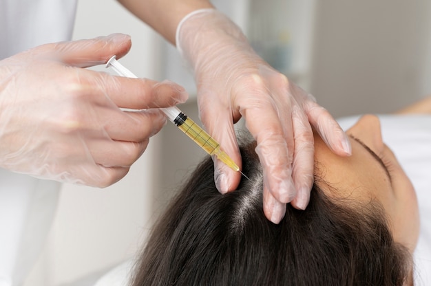 Free photo high angle woman getting scalp prp treatment