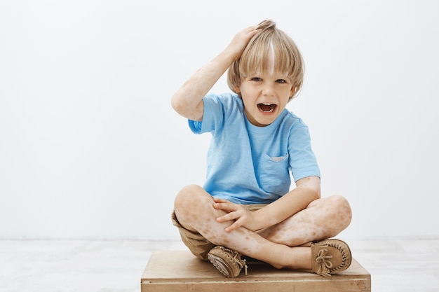 Indoor shot of unhappy cute blond child with vitiligo, having two-colored skin, sitting on floor with crossed feet, touching head and screaming