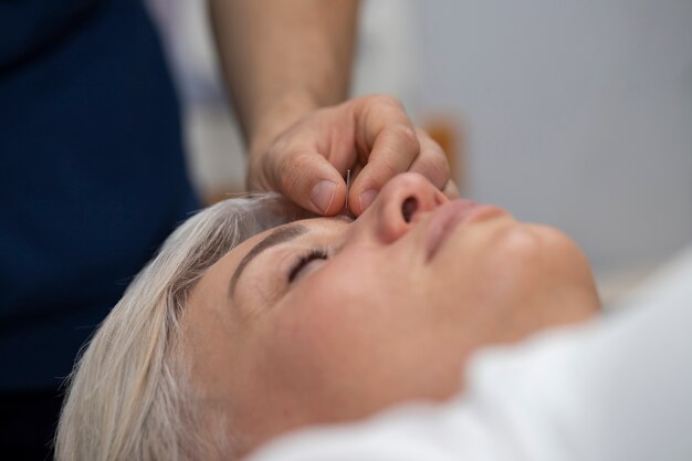 Japanese traditional medicine with needle side view