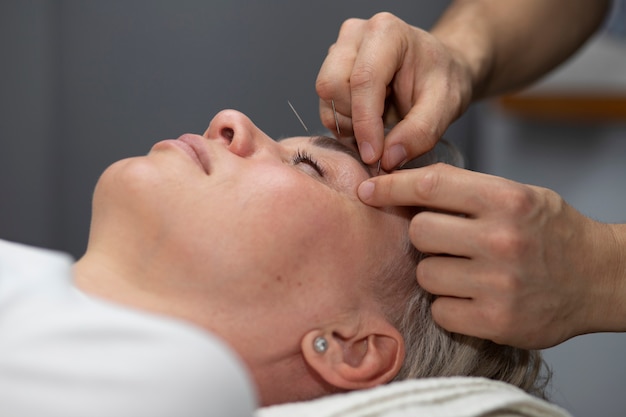 Japanese traditional medicine with needles