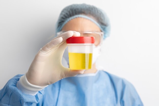 Lab doctor performing medical exam of urine