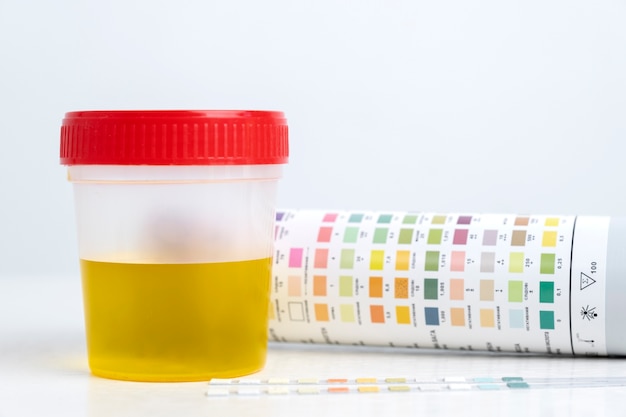 Free photo lab doctor performing medical exam of urine