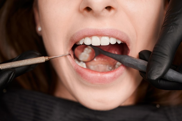 Free photo macro photography of a beautiful female smile with white healthy teeth