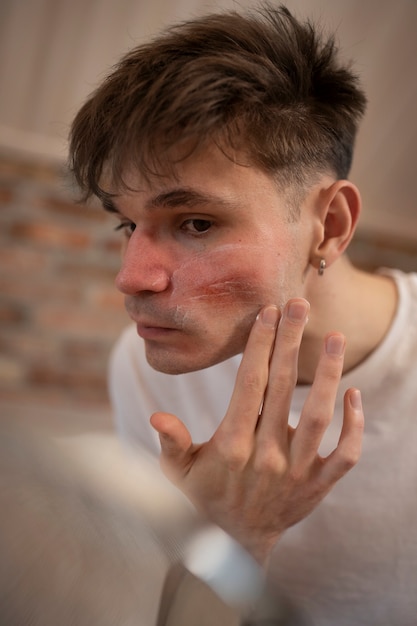 Free Photo man dealing with rosacea skin condition on face