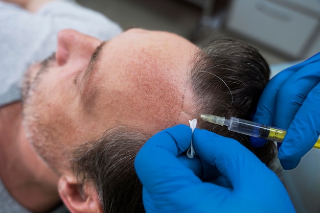 Man getting a hair loss treatment