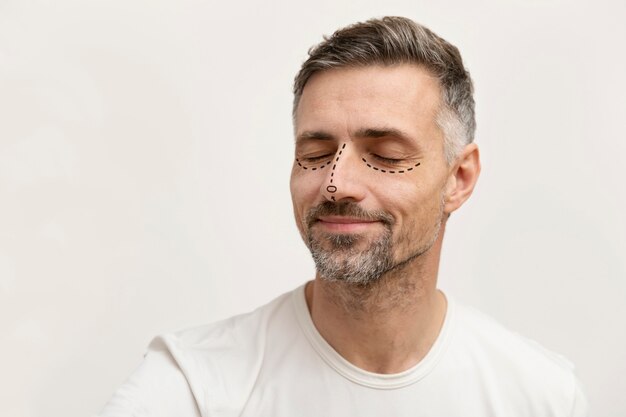 Man getting ready for nose job surgery