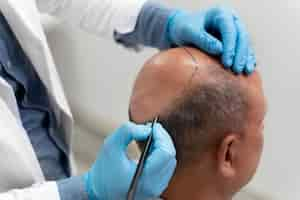 Free photo man going through a follicular unit extraction process