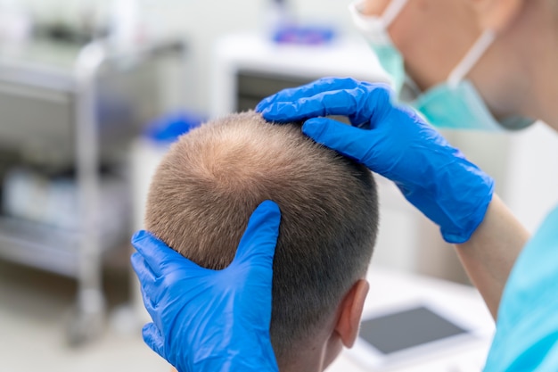 Mature man having balding problems