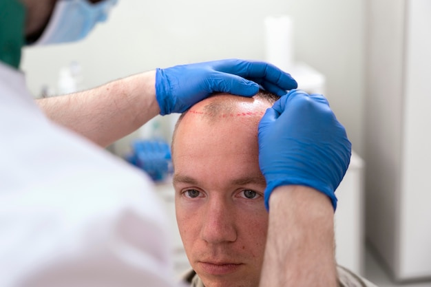 Free photo mature man having balding problems