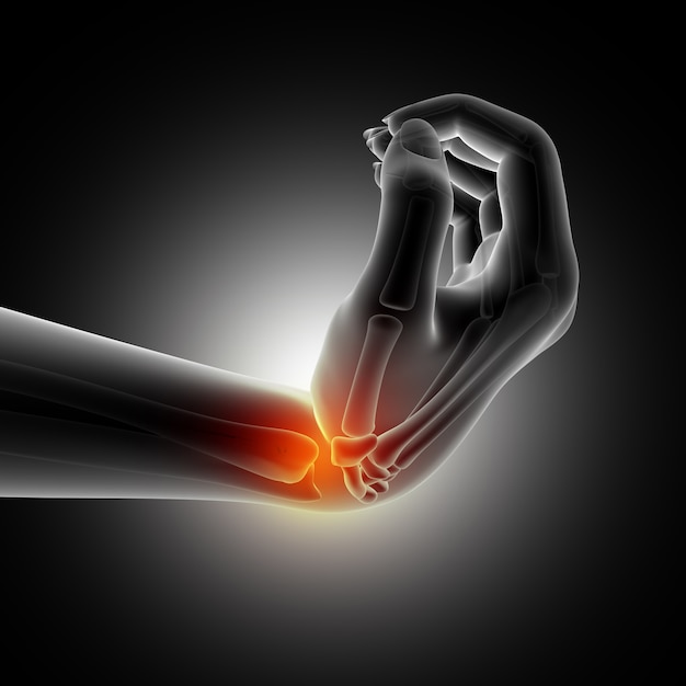 Free Photo medical background showing wrist in bent position