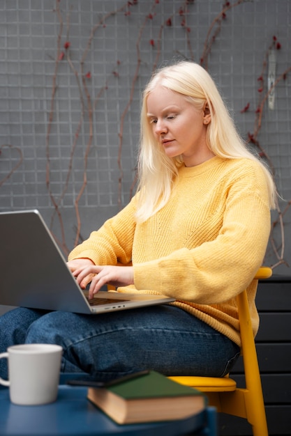 Medium shot albino woman working with laptop