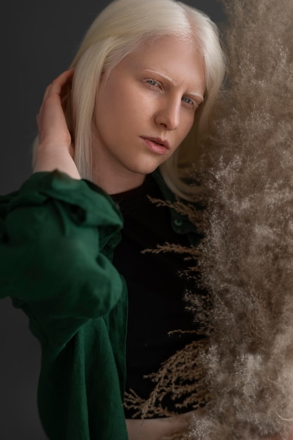 Free photo medium shot woman with albinism posing in studio