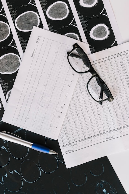 Free photo an overhead view of mri scan with reports; pen and black spectacles