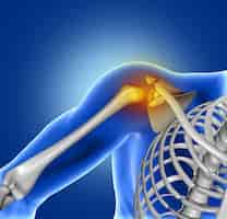 Free photo pain of shoulder joint