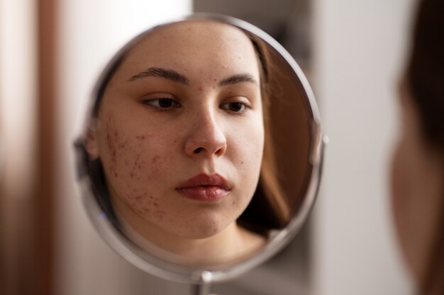 Person dealing with rosacea