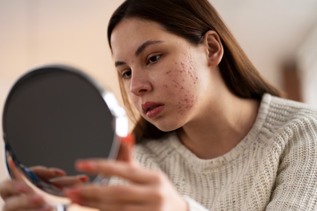 Free Photo person dealing with rosacea