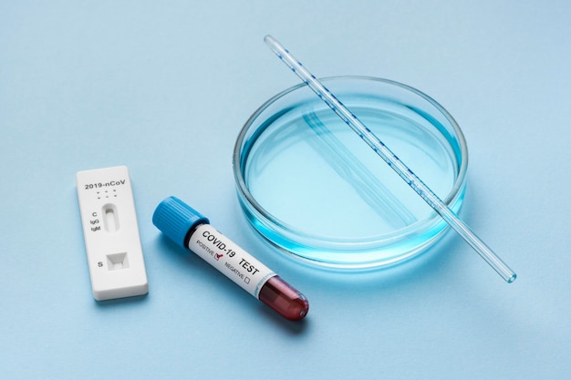 Free photo petri dish and blood sample for covid test