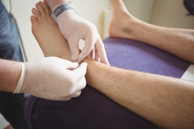 Physiotherapist performing dry needling on the leg of a patient