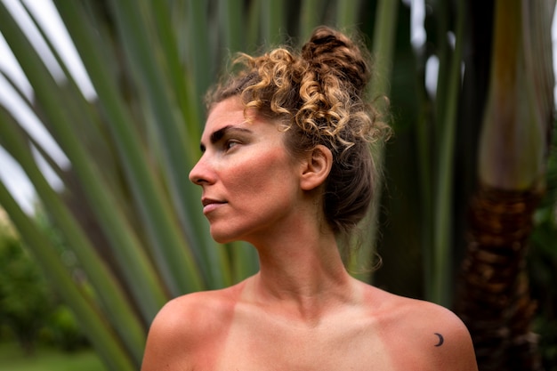 Portrait of adult woman with sunburn skin