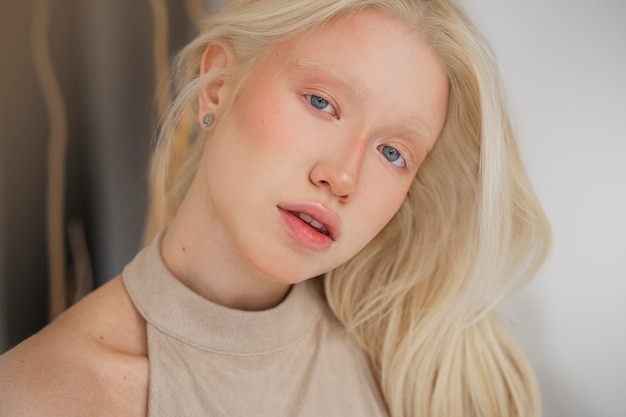 Portrait of beautiful albino woman