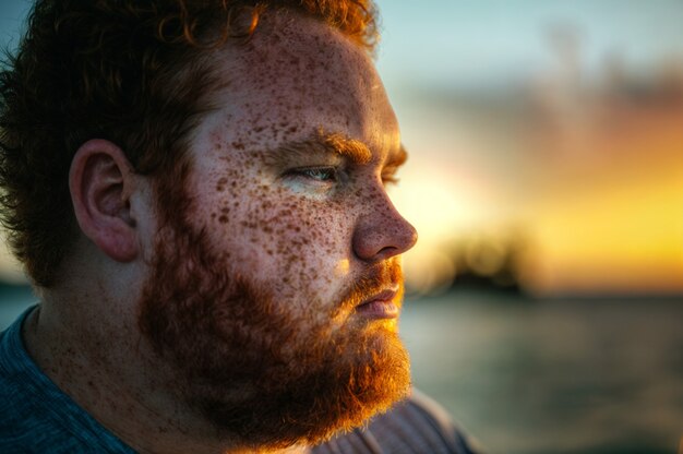 Portrait of man with beauty marks and freckles