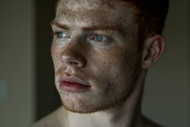 Free photo portrait of man with freckles and beauty marks