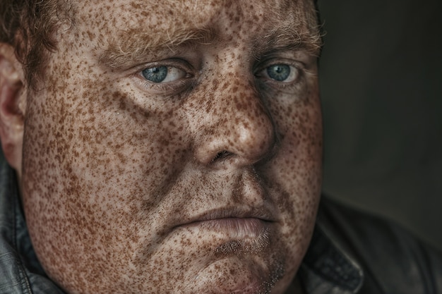 Portrait of man with freckles and beauty marks