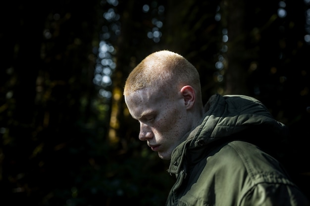 Free photo portrait of man with freckles and beauty marks