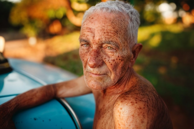 Portrait of man with freckles and beauty marks