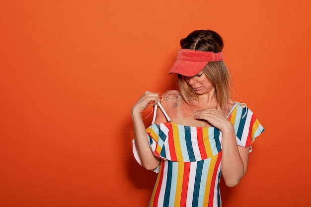 Free photo portrait of woman with sunburn marks on skin