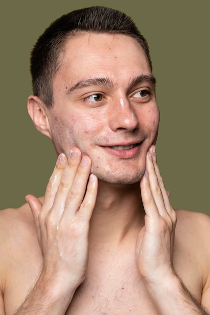 Free Photo portrait of young man being confident with acne