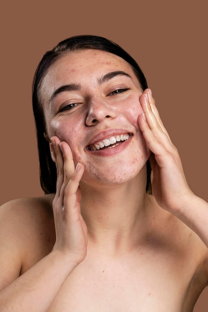 Free Photo portrait of young woman being confident with acne