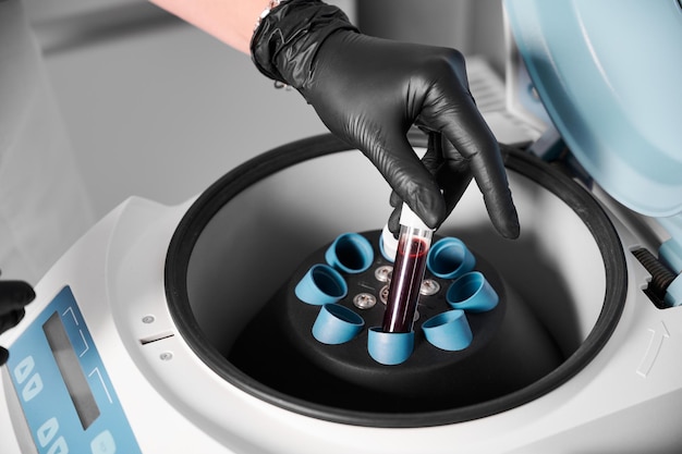 Preparation of blood for injections cosmetologist puts tube of blood in centrifuge