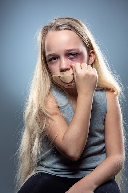 Free photo sad and frightened little girl with bloodshot, bruised eyes and false smile on her mouth.