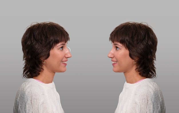 Side view smiley woman before and after rhinoplasty