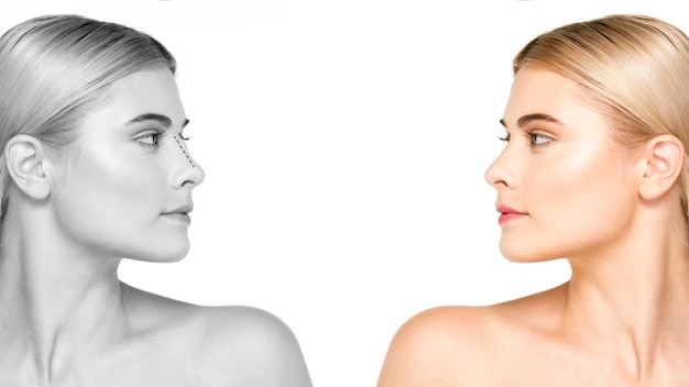 Free Photo side view woman before and after rhinoplasty