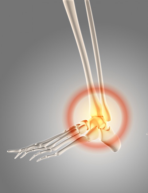 Skeleton 3d, pain in the foot