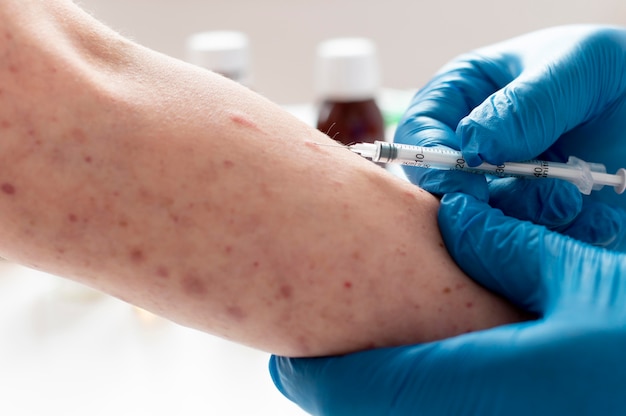 Free Photo skin allergy on a person's arm