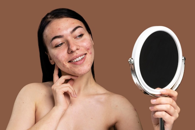 Free Photo smiley woman showing her acne with confidence