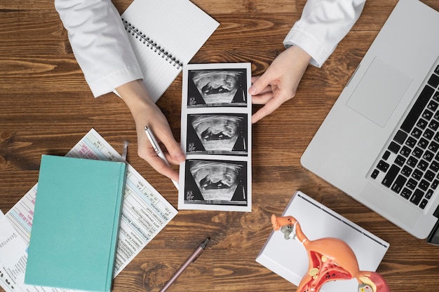 Top view hands holding ultrasounds