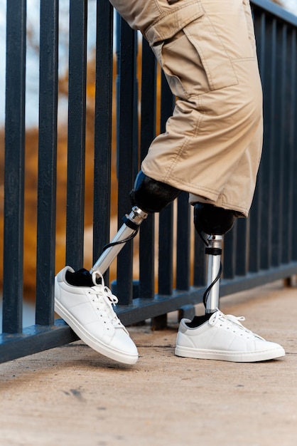 Vertical view of a man with prosthetic legs and white sneakers Rested one foot on the fence