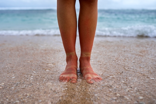 Free photo view of a woman's sunburn feet from wearing sandals at the beach