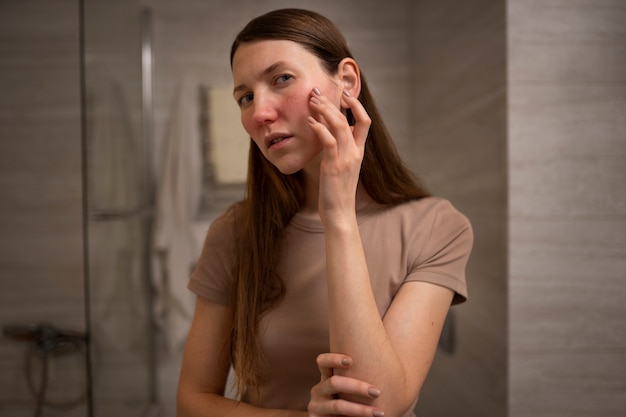 Free Photo woman dealing with rosacea skin condition on face