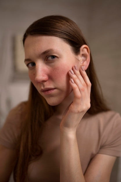 Free Photo woman dealing with rosacea skin condition on face