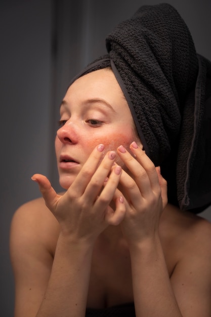 Free Photo woman looking at her rosacea in the mirror