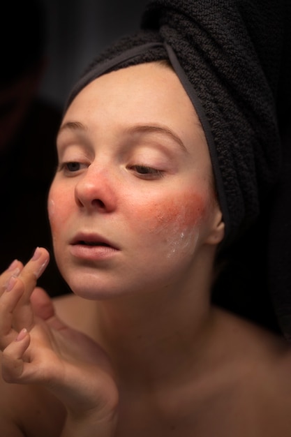 Free photo woman looking at her rosacea in the mirror