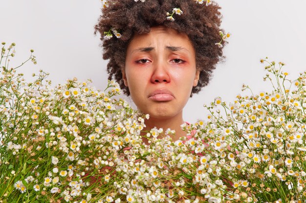 woman surrounded by camomile flowers has red swollen eye srunny nose suffers from seasonal pollen allergy needs consultancy of immunologist