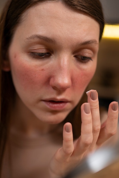 Free Photo woman using moisturizer to help with rosacea skin condition