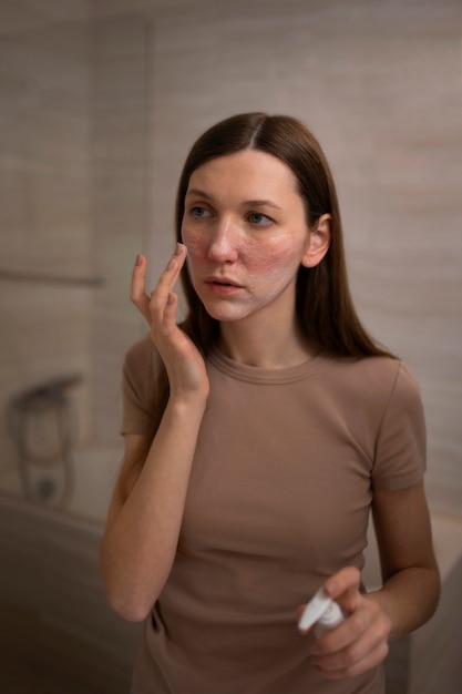 Free Photo woman using moisturizer to help with rosacea skin condition