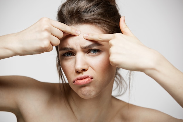 Young brunette girl displeased of her problem acne face skin over white background. Health cosmetology and skincare.